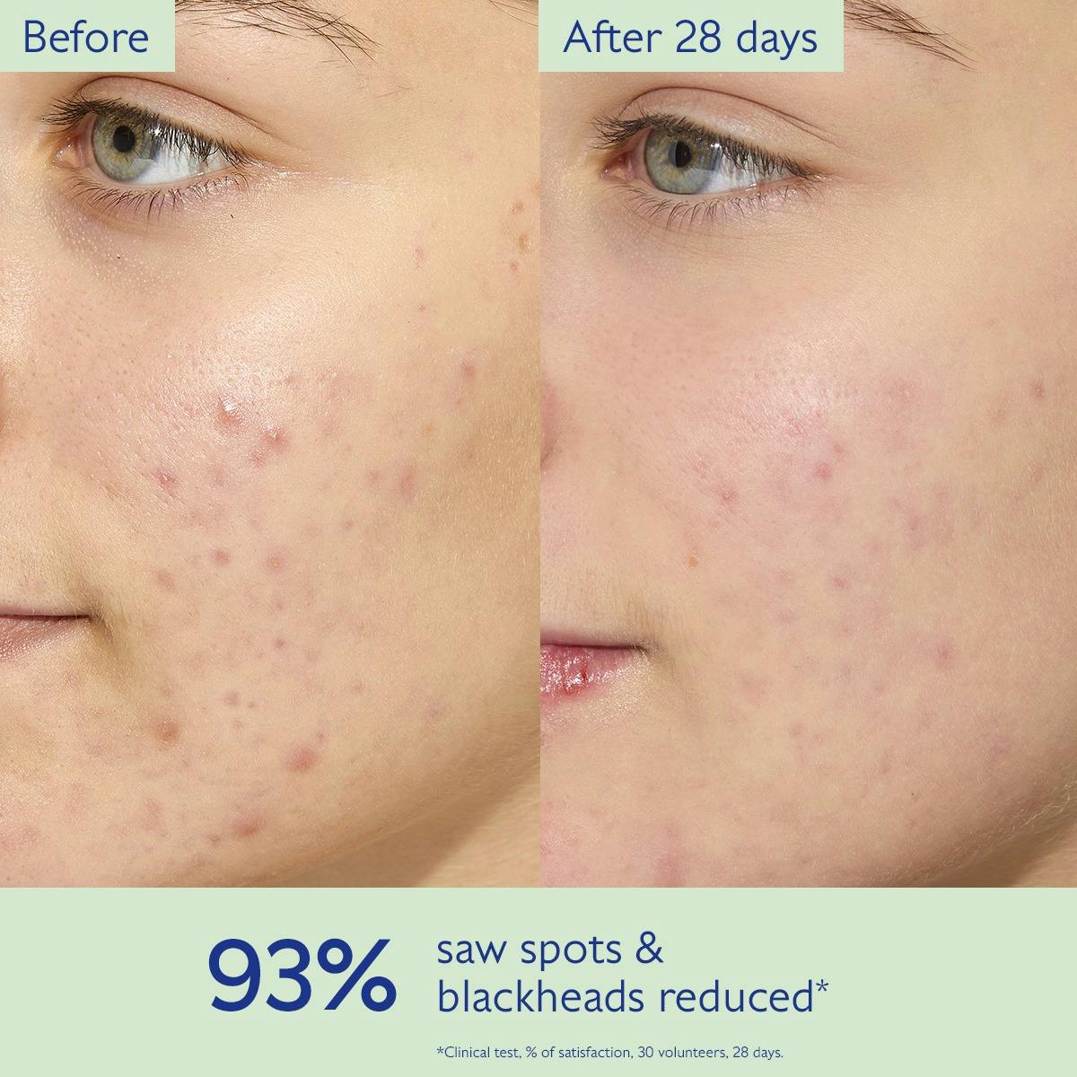 Vinopure Moisturizing Mattifying Fluid 60ML