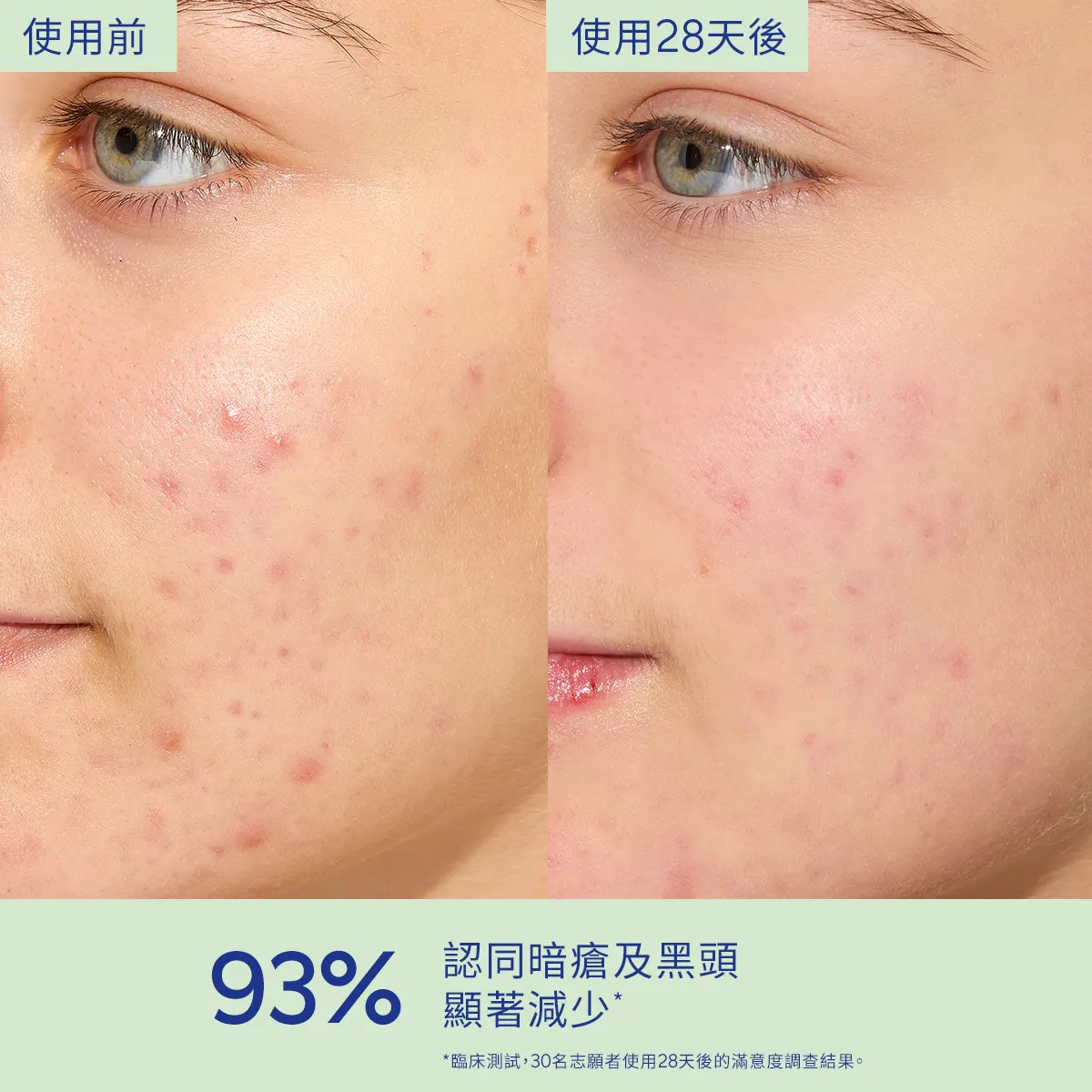 葡萄籽抗痘控油保濕霜 60ML