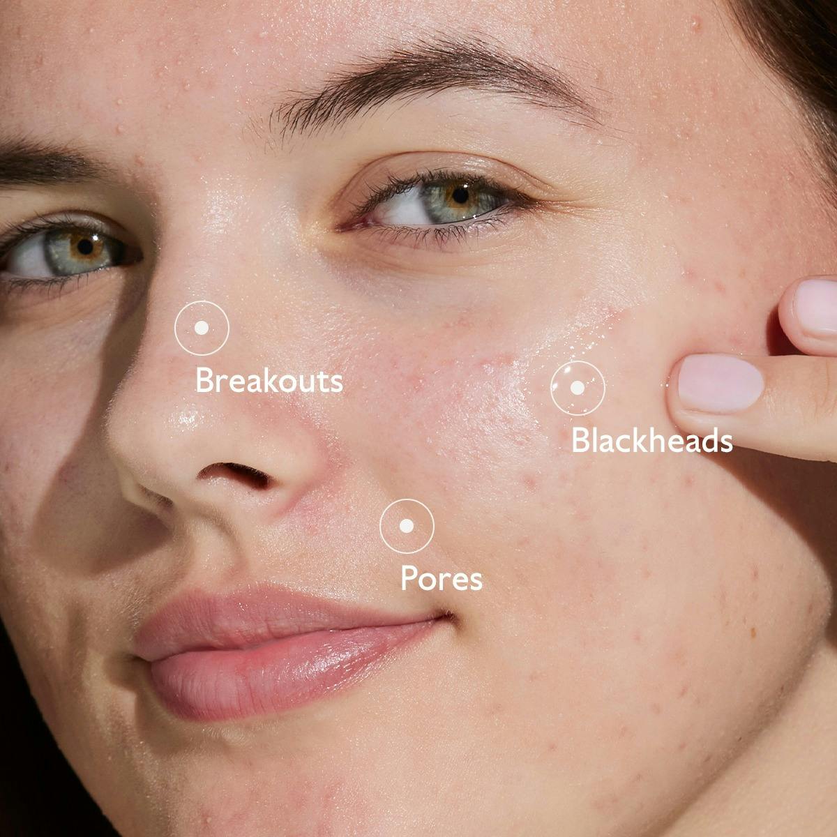 Blemish Control Infusion Serum 30ml