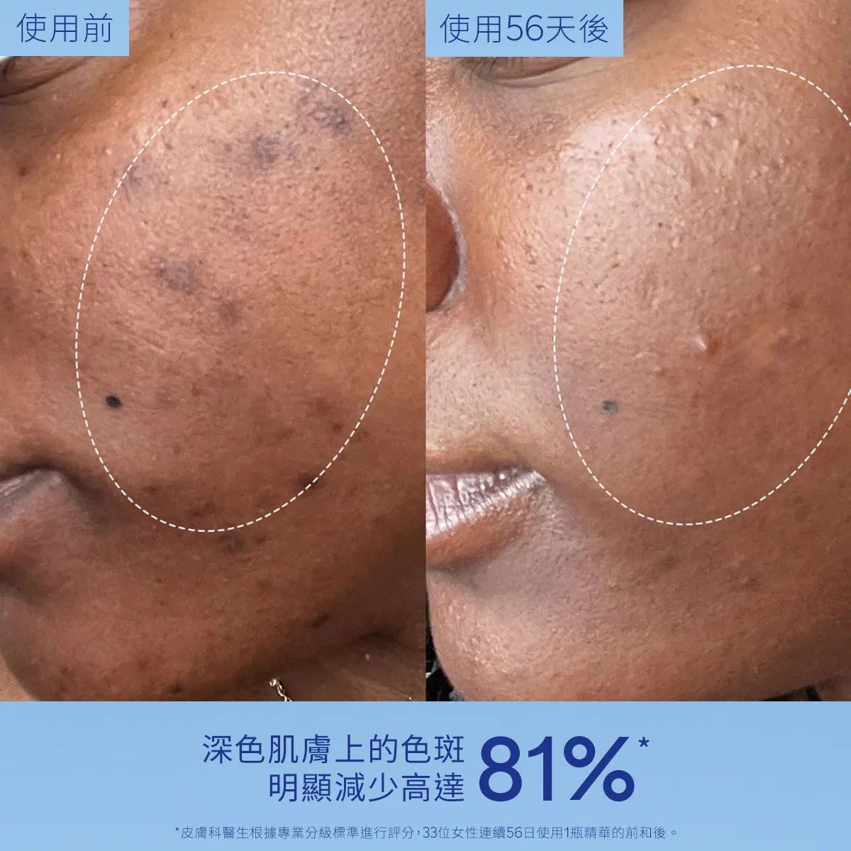 葡萄蔓極緻淡斑亮白精華 30ML