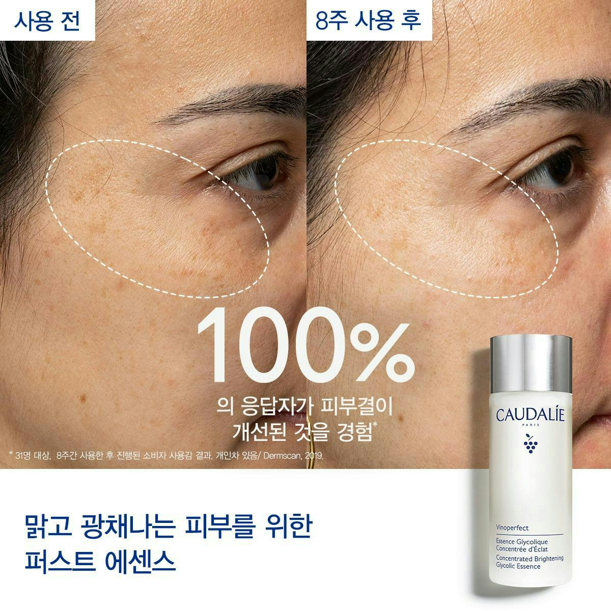 비노퍼펙트 에센스 100ml