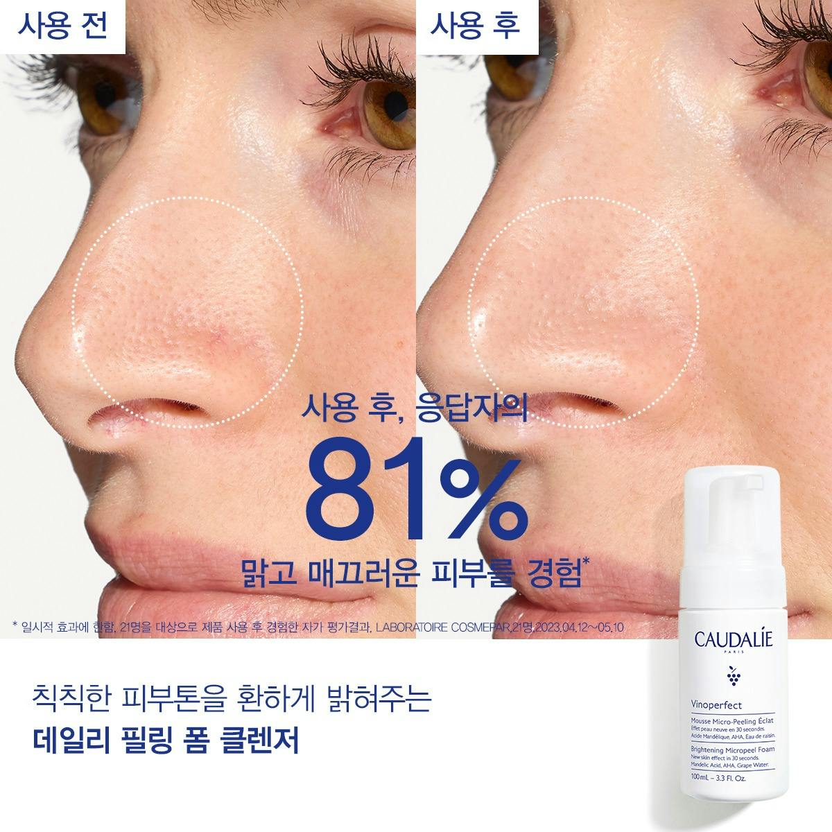 비노퍼펙트 브라이트닝 마이크로필 폼