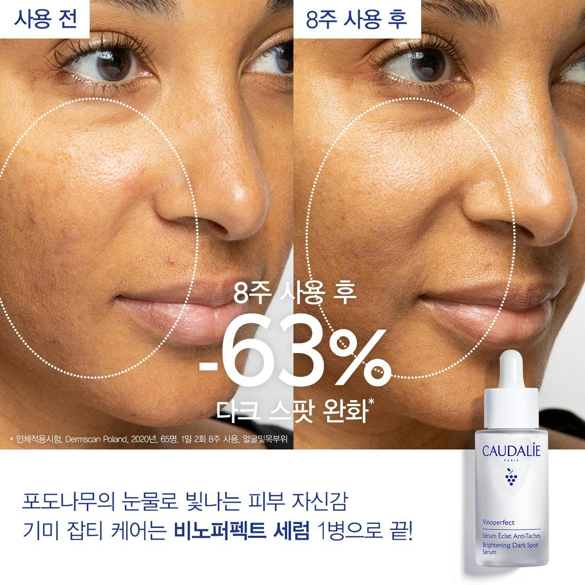 [화이트닝]비노퍼펙트 화이트닝 세럼 30ml