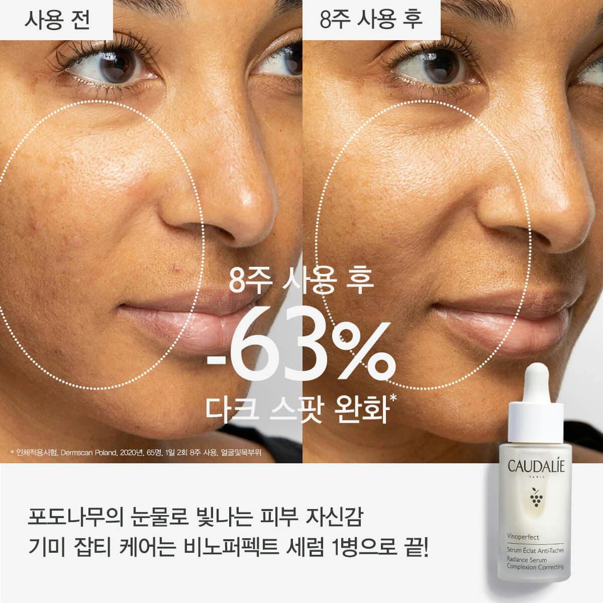 래디언스 세럼 30ml